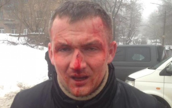 В Киеве хорошо "отоварили" нардепа из ВО "Сволота"